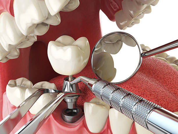 Best Emergency Treatment for Toothache in King George, VA
